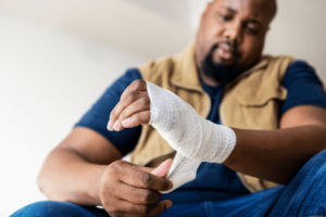 Person wrapping their burn injury and seeking a burn injury lawyer nearby